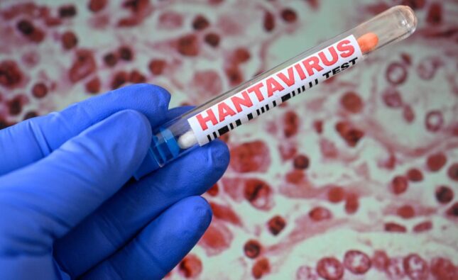 Tânărul din Arad confirmat cu hantavirus a fost externat. Medicii spun că și-a revenit complet