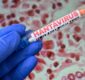 Tânărul din Arad confirmat cu hantavirus a fost externat. Medicii spun că și-a revenit complet